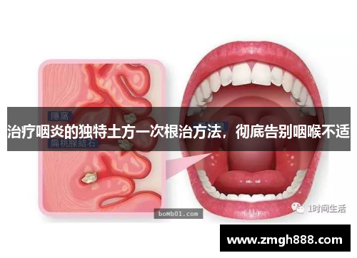 治疗咽炎的独特土方一次根治方法，彻底告别咽喉不适