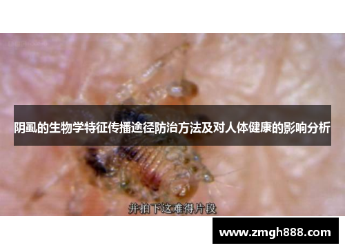 阴虱的生物学特征传播途径防治方法及对人体健康的影响分析